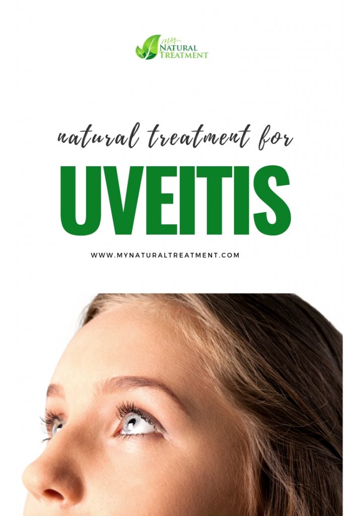 Natural Treatment for Uveitis