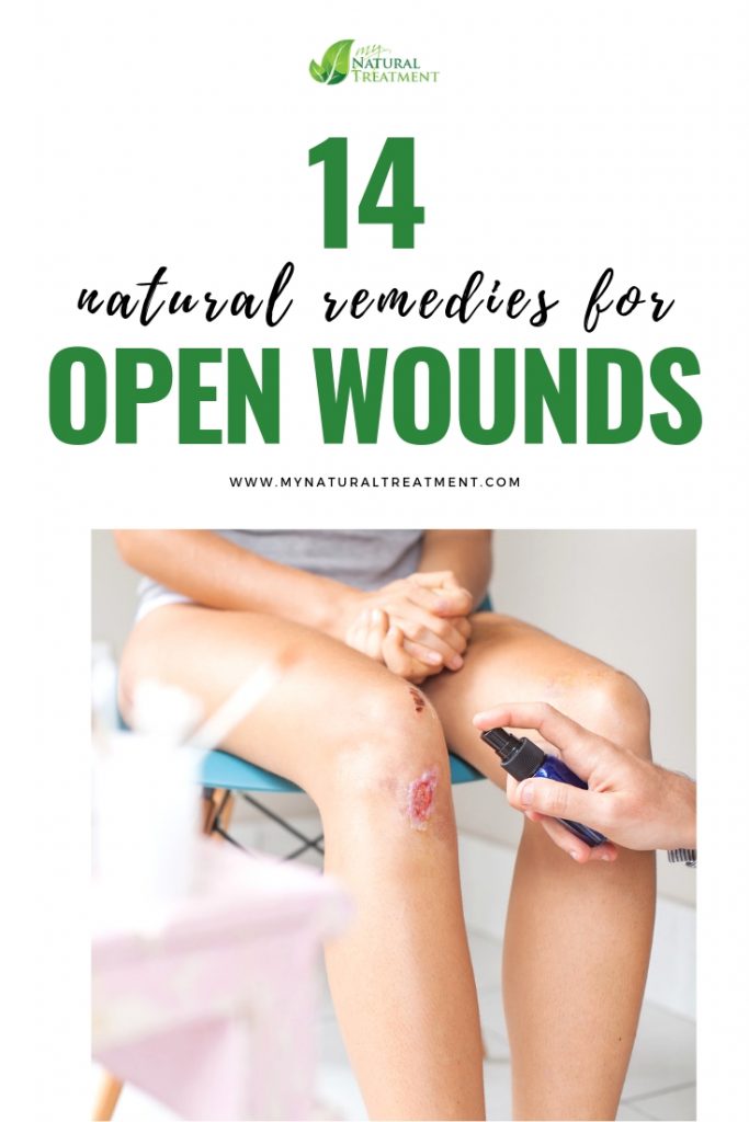 14 Natural Remedies for Open Wounds