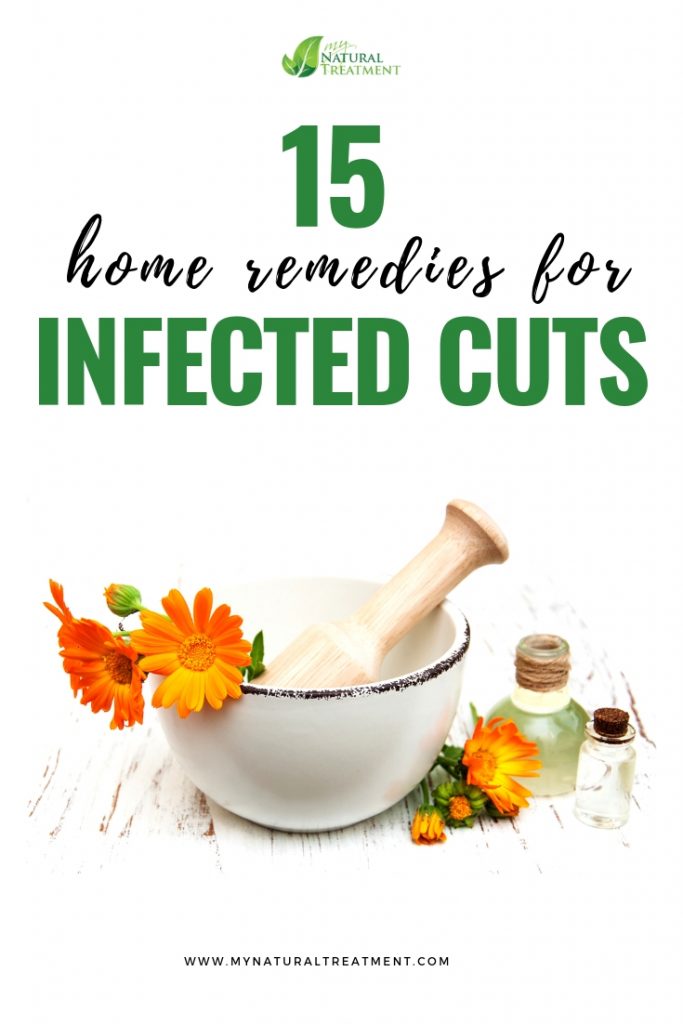 15 Home Remedies for Infected Cuts
