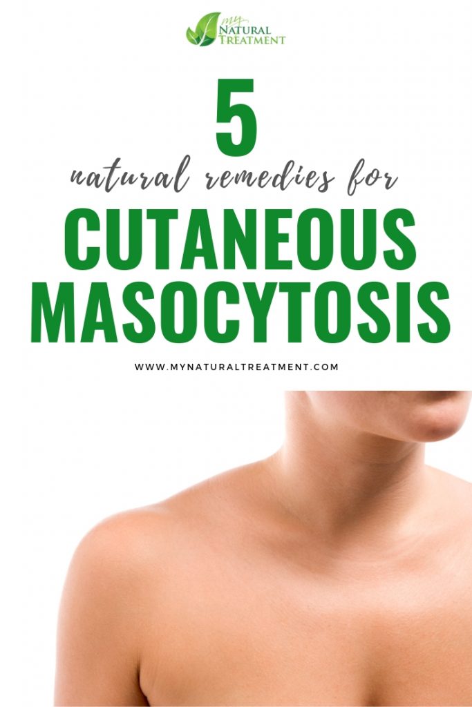 Natural Remedies for Cutaneous Mastocytosis