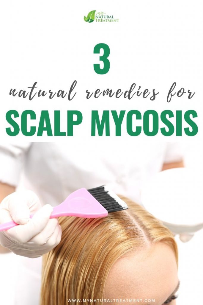 3 Natural Remedies for Scalp Mycosis