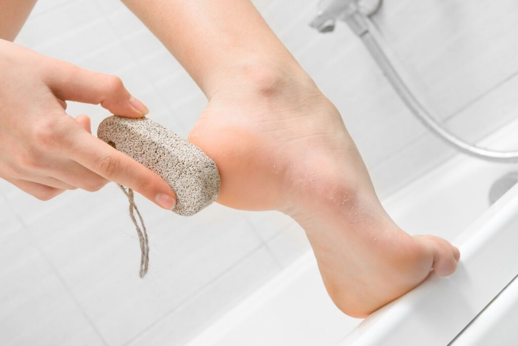 Pumice Feet - Natural Remedies for Cracked Heels - MyNaturalTreatment.com