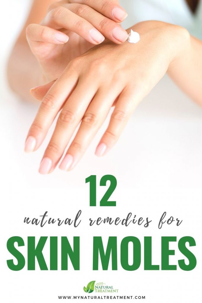 12 Natural Remedies for Skin Moles & Skin Tags