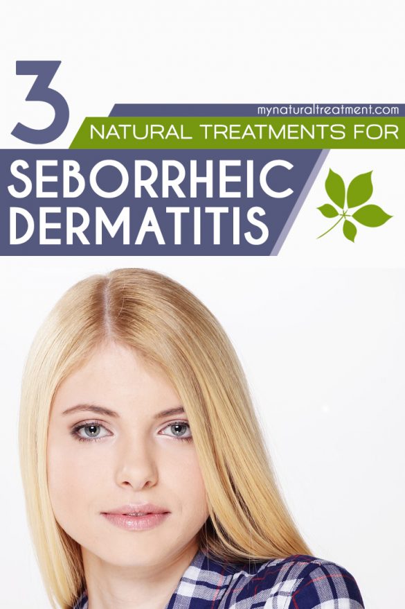 3 Natural Treatments For Seborrheic Dermatitis That Work