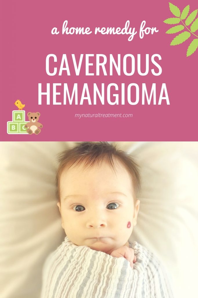 Here is a simple home remedy for cavernous hemangioma with herbs! #hemangionaremedy #cavernoushemangioma #homeremedy
