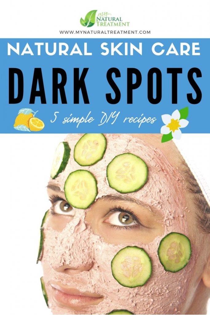 5 Natural Skin Care for Dark Spots on Face DIY #darkspotsonface #darkspots