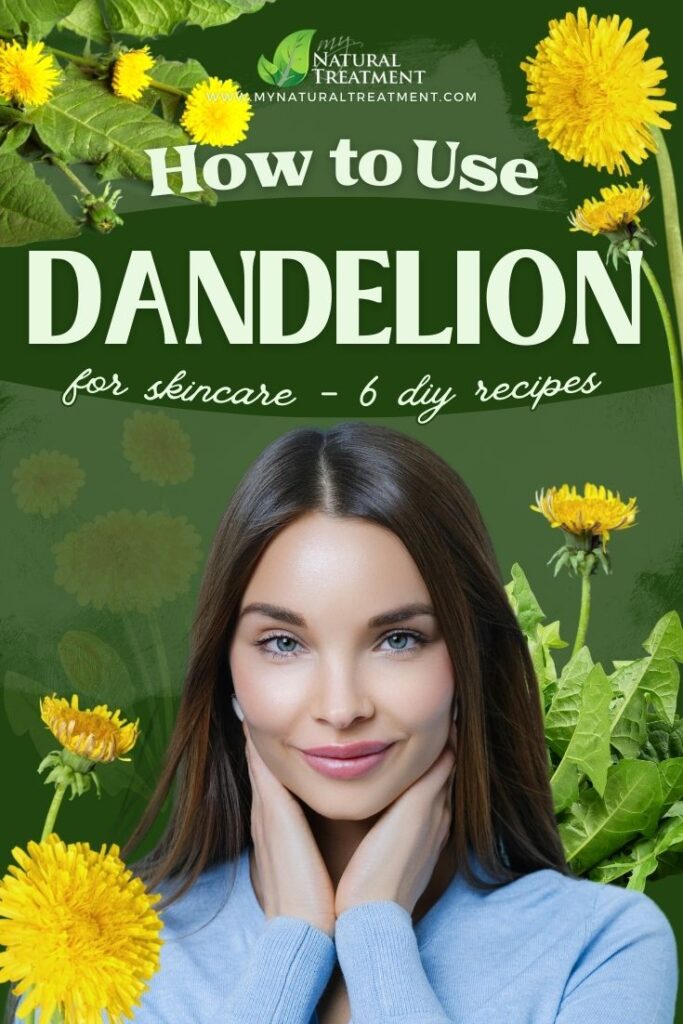 How to Use Dandelion for Skin - 6 DIY Skincare Recipes with Dandelion Leaves - MyNaturalTreatment.com