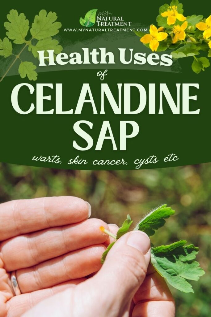 How to Harvest Celandine - Health Uses of Celandine Sap Uses - Celandine Sap Benefits - MyNaturalTreatment.com