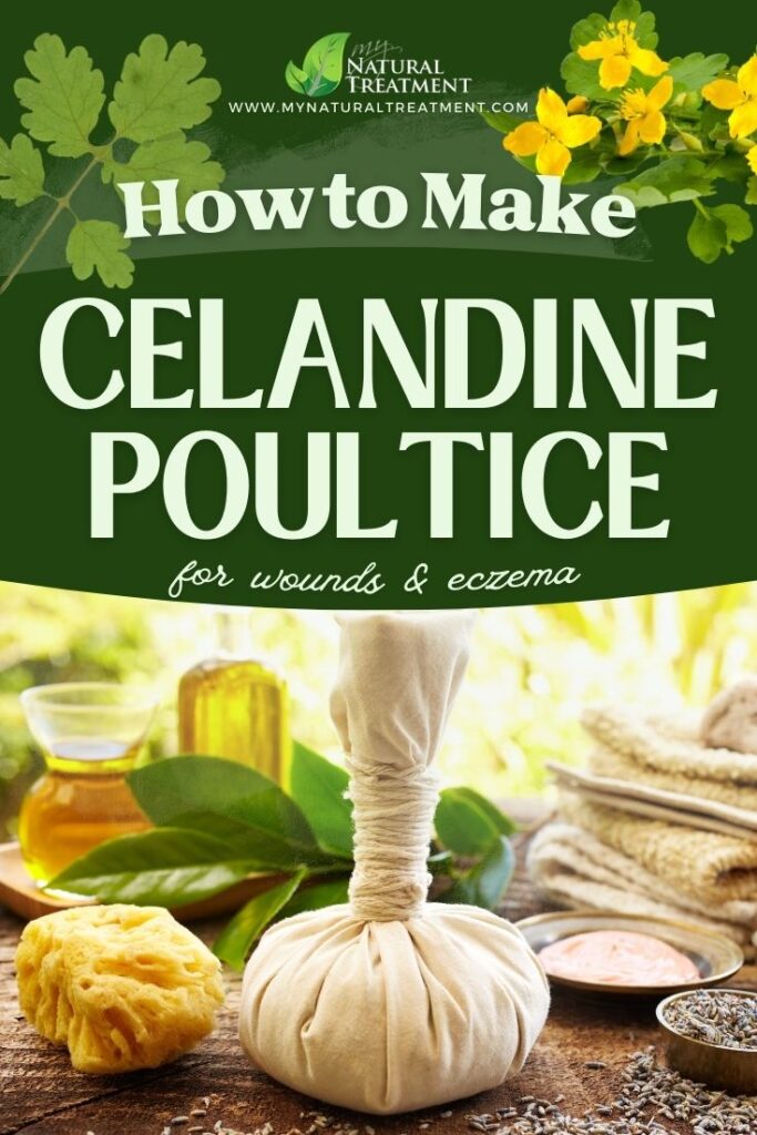 How to Harvest Celandine How to Make Celandine Poultice Uses Celandine Poultice Benefits MyNaturalTreatment.com
