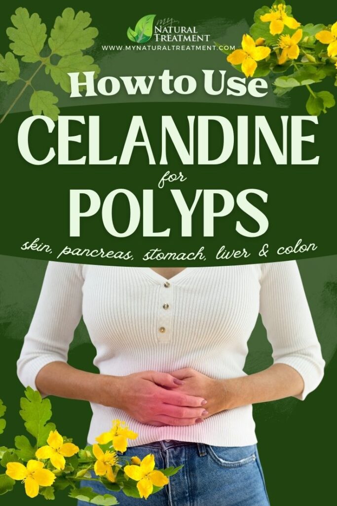 How to Use Celandine for Polyps - Celandine Remedies - Natural Remedies for Polyps - MyNaturalTreatment.com