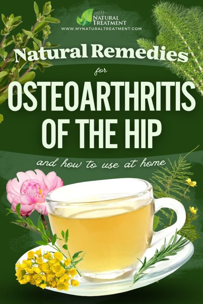  10 Herbal Natural Remedies for Osteoarthritis of The Hip (Coxarthrosis) - MyNaturalTreatment.com
