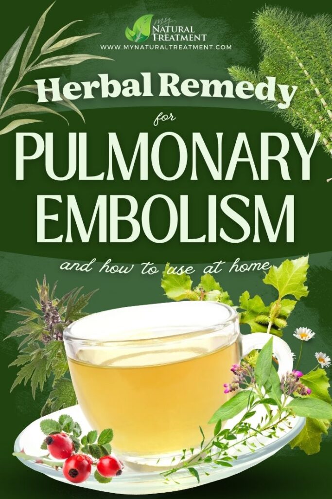 Powerful Herbal Remedy for Pulmonary Embolism MyNaturalTreatment.com 1