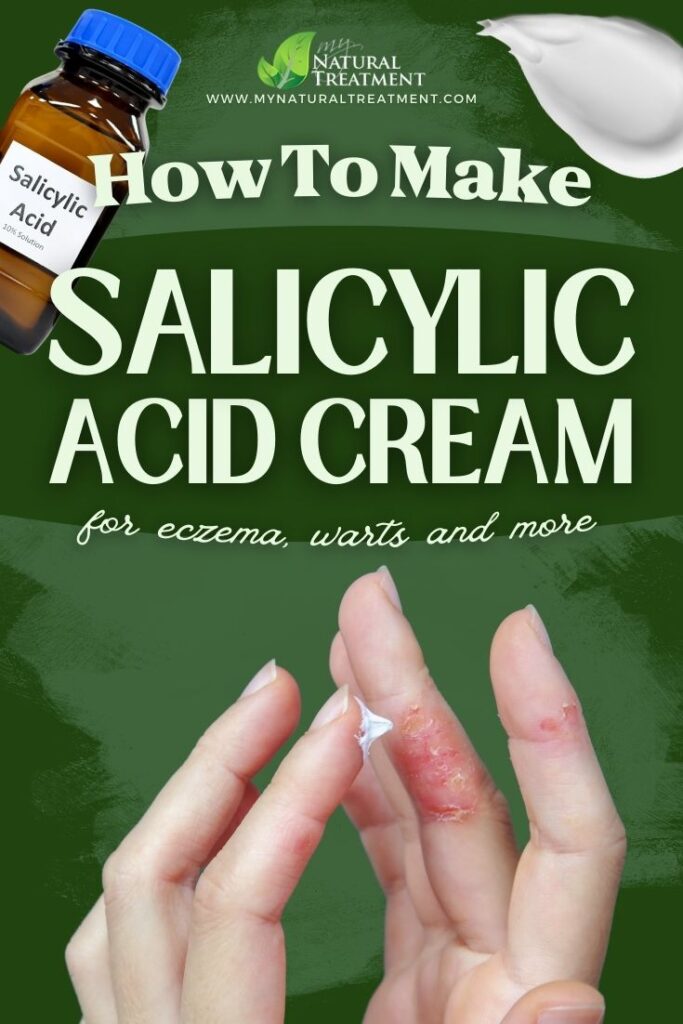 How to Make Salicylic Acid Cream for Eczema - MyNaturalTreatment.com