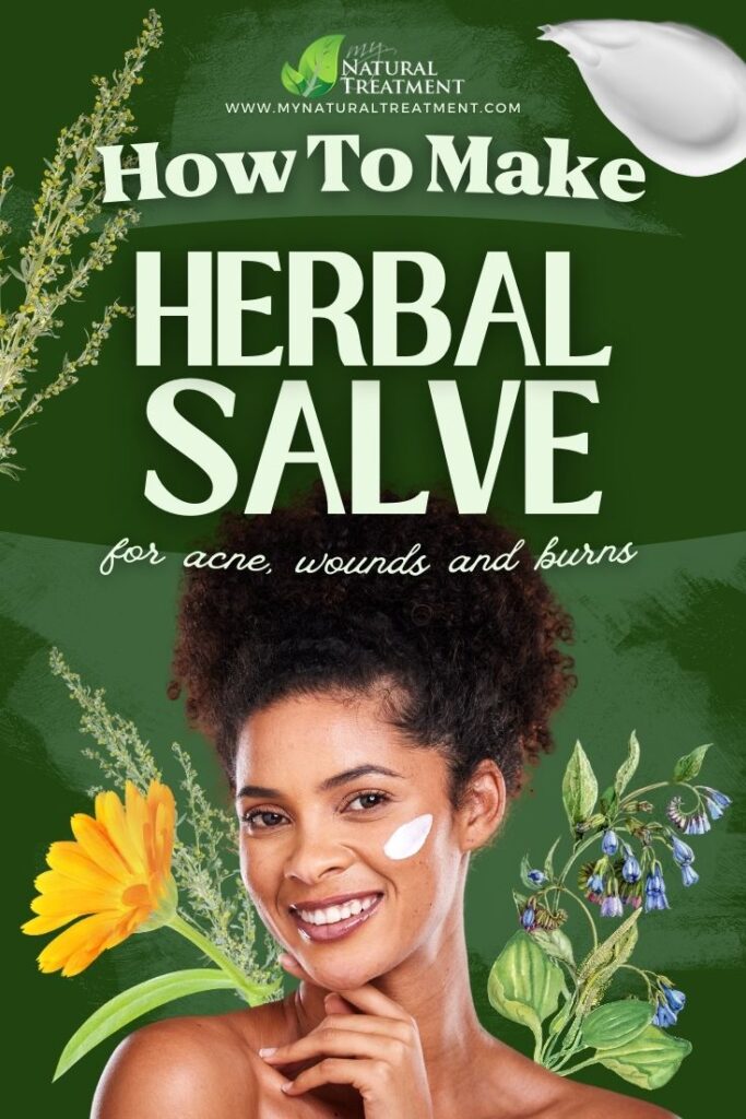 How to Make Herbal Salve for Acne - MyNaturalTreatment.com