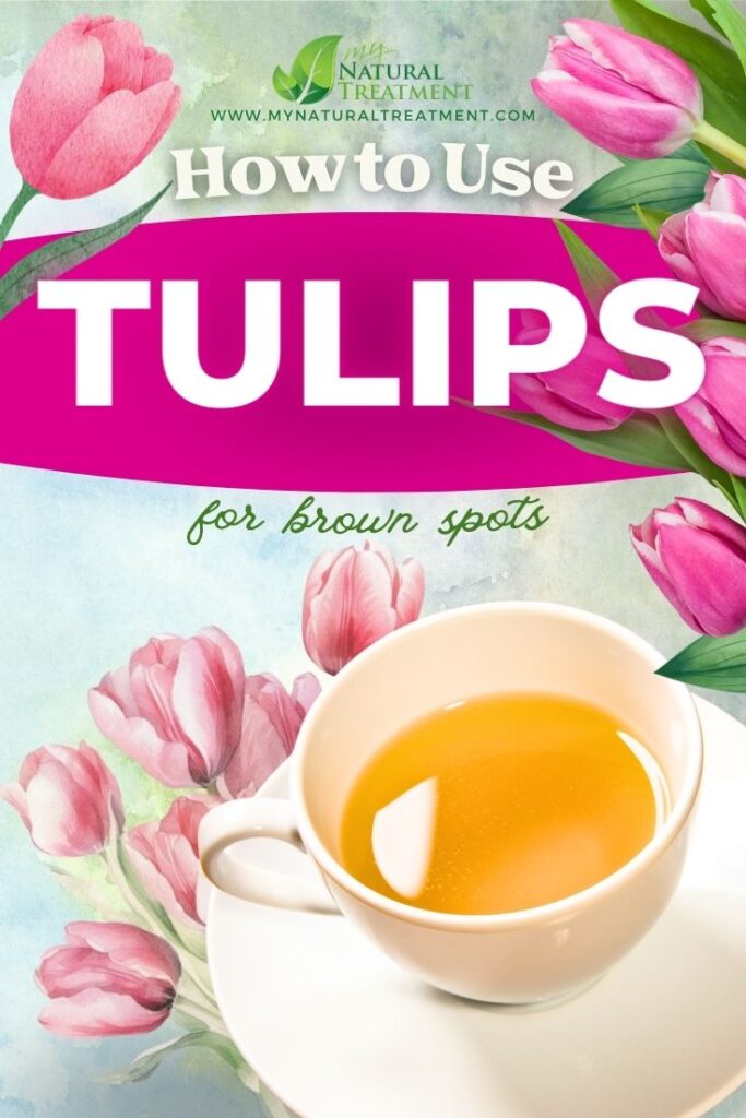 How to Use Tulips for Brown Spots 4 How to Use Tulips for Brown Spots - Tulip Uses - Tulip Remedies - MyNaturalTreatment.com