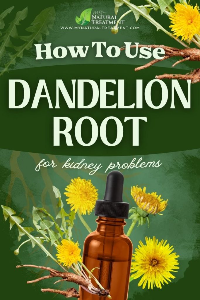 How to Use Dandelion Root for Kidney Problems 5 How to Use Dandelion Root for Kidney Problems - MyNaturalTreatment.com