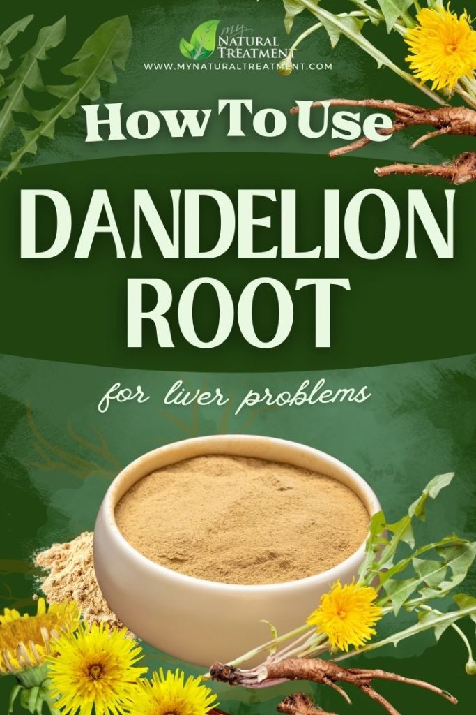 How to Use Dandelion Root for Liver Problems 5 How to Use Dandelion Root for Liver Problems - MyNaturalTreatment.com