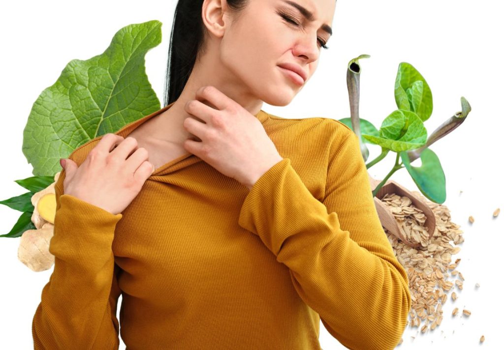 9 Topical Home Remedies for Hives Itch 3 Topical Home Remedies for Hives Itch - MyNaturalTreatment.com
