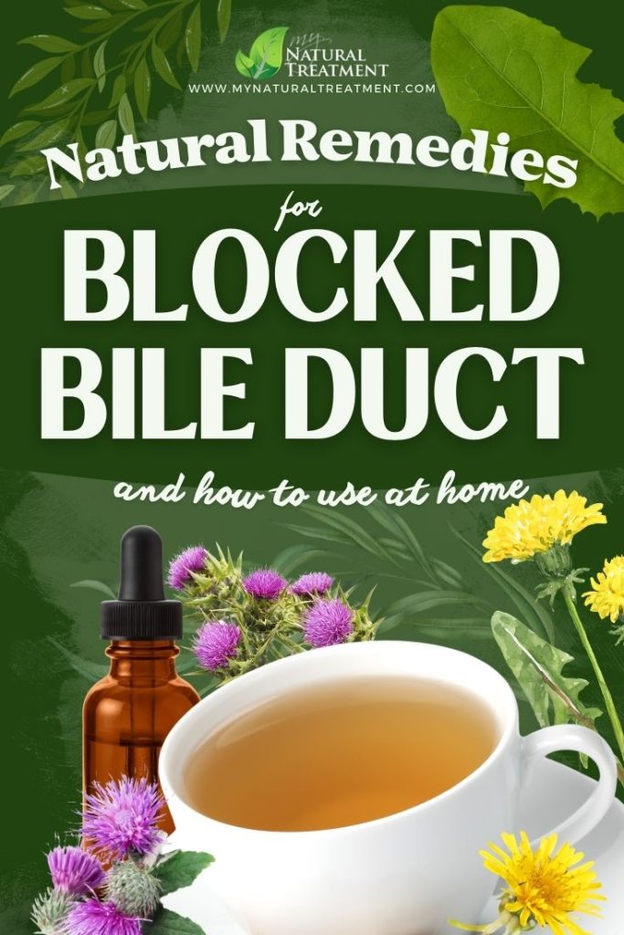 4 Natural Remedies for Blocked Bile Ducts (Herbs & Supplements) 12 4 Natural Remedies for Blocked Bile Ducts - MyNaturalTreatment.com