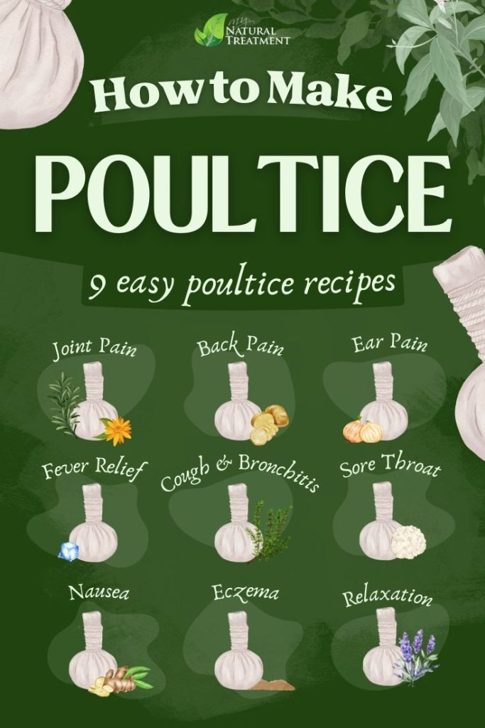 What Is a Poultice? 9 Easy Poultice Recipes for Pain Relief, Colds and More 6 What Is a Poultice? 9 Easy Poultice Recipes for Pain Relief, Colds and More - MyNaturalTreatment.com