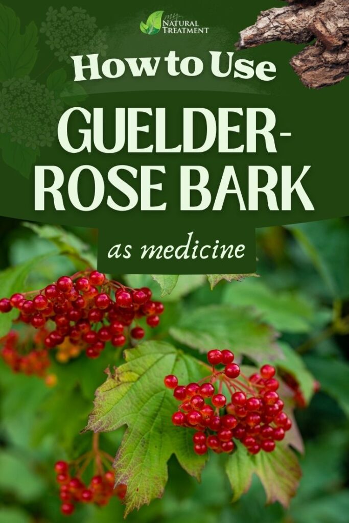 How to Use Guelder-Rose Bark as Medicine 4 How to Use Guelder-Rose Bark as Medicine - MyNaturalTreatment